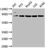 Western Blot<br />
 Positive WB detected in: 293 whole cell lysate, PC-3 whole cell lysate, HepG2 whole cell lysate, LO2 whole cell lysate, A549 whole cell lysate<br />
 All lanes: NLN antibody at 3.2µg/ml<br />
 Secondary<br />
 Goat polyclonal to rabbit IgG at 1/50000 dilution<br />
 Predicted band size: 81 kDa<br />
 Observed band size: 81 kDa<br />