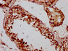 IHC image of CSB-PA867143LA01HU diluted at 1:200 and staining in paraffin-embedded human testis tissue performed on a Leica BondTM system. After dewaxing and hydration, antigen retrieval was mediated by high pressure in a citrate buffer (pH 6.0) . Section was blocked with 10% normal goat serum 30min at RT. Then primary antibody (1% BSA) was incubated at 4°C overnight. The primary is detected by a biotinylated secondary antibody and visualized using an HRP conjugated SP system.