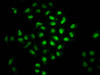 Immunofluorescence staining of Hela cells with CSB-PA867143LA01HU at 1:66, counter-stained with DAPI. The cells were fixed in 4% formaldehyde, permeabilized using 0.2% Triton X-100 and blocked in 10% normal Goat Serum. The cells were then incubated with the antibody overnight at 4°C. The secondary antibody was Alexa Fluor 488-congugated AffiniPure Goat Anti-Rabbit IgG (H+L) .
