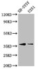 Western Blot<br />
 Positive WB detected in: SH-SY5Y whole cell lysate, U251 whole cell lysate<br />
 All lanes: BARHL1 antibody at 3.4µg/ml<br />
 Secondary<br />
 Goat polyclonal to rabbit IgG at 1/50000 dilution<br />
 Predicted band size: 36 kDa<br />
 Observed band size: 36 kDa<br />