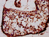 IHC image of CSB-PA880147LA01HU diluted at 1:400 and staining in paraffin-embedded human testis tissue performed on a Leica BondTM system. After dewaxing and hydration, antigen retrieval was mediated by high pressure in a citrate buffer (pH 6.0) . Section was blocked with 10% normal goat serum 30min at RT. Then primary antibody (1% BSA) was incubated at 4°C overnight. The primary is detected by a biotinylated secondary antibody and visualized using an HRP conjugated SP system.