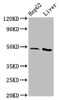 Western Blot<br />
 Positive WB detected in: HepG2 whole cell lysate, Rat liver tissue<br />
 All lanes: APMAP antibody at 3.1µg/ml<br />
 Secondary<br />
 Goat polyclonal to rabbit IgG at 1/50000 dilution<br />
 Predicted band size: 47, 33 kDa<br />
 Observed band size: 47 kDa<br />