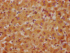 IHC image of CSB-PA884629LA01HU diluted at 1:400 and staining in paraffin-embedded human liver tissue performed on a Leica BondTM system. After dewaxing and hydration, antigen retrieval was mediated by high pressure in a citrate buffer (pH 6.0) . Section was blocked with 10% normal goat serum 30min at RT. Then primary antibody (1% BSA) was incubated at 4°C overnight. The primary is detected by a biotinylated secondary antibody and visualized using an HRP conjugated SP system.