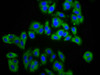Immunofluorescence staining of HepG2 cells with CSB-PA884629LA01HU at 1:133, counter-stained with DAPI. The cells were fixed in 4% formaldehyde, permeabilized using 0.2% Triton X-100 and blocked in 10% normal Goat Serum. The cells were then incubated with the antibody overnight at 4°C. The secondary antibody was Alexa Fluor 488-congugated AffiniPure Goat Anti-Rabbit IgG (H+L) .