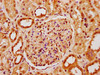 IHC image of CSB-PA889087LA01HU diluted at 1:400 and staining in paraffin-embedded human kidney tissue performed on a Leica BondTM system. After dewaxing and hydration, antigen retrieval was mediated by high pressure in a citrate buffer (pH 6.0) . Section was blocked with 10% normal goat serum 30min at RT. Then primary antibody (1% BSA) was incubated at 4°C overnight. The primary is detected by a biotinylated secondary antibody and visualized using an HRP conjugated SP system.
