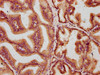 IHC image of CSB-PA890926LA01HU diluted at 1:400 and staining in paraffin-embedded human prostate tissue performed on a Leica BondTM system. After dewaxing and hydration, antigen retrieval was mediated by high pressure in a citrate buffer (pH 6.0) . Section was blocked with 10% normal goat serum 30min at RT. Then primary antibody (1% BSA) was incubated at 4°C overnight. The primary is detected by a biotinylated secondary antibody and visualized using an HRP conjugated SP system.