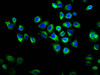 Immunofluorescence staining of Hela cells with CSB-PA897493LA01HU at 1:133, counter-stained with DAPI. The cells were fixed in 4% formaldehyde, permeabilized using 0.2% Triton X-100 and blocked in 10% normal Goat Serum. The cells were then incubated with the antibody overnight at 4°C. The secondary antibody was Alexa Fluor 488-congugated AffiniPure Goat Anti-Rabbit IgG (H+L) . Immunofluorescence staining of Hela cells with CSB-PA897493LA01HU at 1:133, counter-stained with DAPI. The cells were fixed in 4% formaldehyde, permeabilized using 0.2% Triton X-100 and blocked in 10% normal Goat Serum. The cells were then incubated with the antibody overnight at 4°C. The secondary antibody was Alexa Fluor 488-congugated AffiniPure Goat Anti-Rabbit IgG (H+L) .