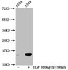 Western Blot<br />
 Detected samples: A549 whole cell lysate; Untreated (-) or treated (+) with 100ng/ml EGF for 20min<br />
 All lanes: HIST1H2BC antibody at 1:100<br />
 Secondary<br />
 Goat polyclonal to rabbit IgG at 1/50000 dilution<br />
 Predicted band size: 14 kDa<br />
 Observed band size: 14 kDa<br />