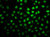 Immunofluorescence staining of Hela cells (treated with 30mM sodium butyrate for 4h) with CSB-PA010403OA20hibHU at 1:7.5, counter-stained with DAPI. The cells were fixed in 4% formaldehyde, permeabilized using 0.2% Triton X-100 and blocked in 10% normal Goat Serum. The cells were then incubated with the antibody overnight at 4°C. The secondary antibody was Alexa Fluor 488-congugated AffiniPure Goat Anti-Rabbit IgG (H+L) .