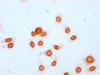 Immunocytochemistry analysis of CSB-PA010403OA20acHU diluted at 1:15 and staining in Hela cells (treated with 30mM sodium butyrate for 4h) performed on a Leica BondTM system. The cells were fixed in 4% formaldehyde, permeabilized using 0.2% Triton X-100 and blocked with 10% normal goat serum 30min at RT. Then primary antibody (1% BSA) was incubated at 4°C overnight. The primary is detected by a biotinylated secondary antibody and visualized using an HRP conjugated SP system. Immunocytochemistry analysis of CSB-PA010403OA20acHU diluted at 1:15 and staining in Hela cells (treated with 30mM sodium butyrate for 4h) performed on a Leica BondTM system. The cells were fixed in 4% formaldehyde, permeabilized using 0.2% Triton X-100 and blocked with 10% normal goat serum 30min at RT. Then primary antibody (1% BSA) was incubated at 4°C overnight. The primary is detected by a biotinylated secondary antibody and visualized using an HRP conjugated SP system.