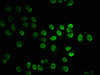 Immunofluorescence staining of Hela cells (treated with 30mM sodium butyrate for 4h) with CSB-PA010403OA20acHU at 1:7.5, counter-stained with DAPI. The cells were fixed in 4% formaldehyde, permeabilized using 0.2% Triton X-100 and blocked in 10% normal Goat Serum. The cells were then incubated with the antibody overnight at 4°C. The secondary antibody was Alexa Fluor 488-congugated AffiniPure Goat Anti-Rabbit IgG (H+L) . Immunofluorescence staining of Hela cells (treated with 30mM sodium butyrate for 4h) with CSB-PA010403OA20acHU at 1:7.5, counter-stained with DAPI. The cells were fixed in 4% formaldehyde, permeabilized using 0.2% Triton X-100 and blocked in 10% normal Goat Serum. The cells were then incubated with the antibody overnight at 4°C. The secondary antibody was Alexa Fluor 488-congugated AffiniPure Goat Anti-Rabbit IgG (H+L) .