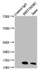 Immunoprecipitating HIST1H2BC in A549 whole cell lysate (treated with 30mM sodium butyrate for 4h) <br />
 Lane 1: Rabbit control IgG instead of CSB-PA010403OA20acHU in A549 whole cell lysate (treated with 30mM sodium butyrate for 4h) .
 For western blotting, a HRP-conjugated Protein G antibody was used as the secondary antibody (1/2000) <br />
 Lane 2: CSB-PA010403OA20acHU (5µg) + A549 whole cell lysate (treated with 30mM sodium butyrate for 4h) (500µg) <br />
 Lane 3: A549 whole cell lysate (treated with 30mM sodium butyrate for 4h) (20µg) <br />