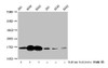 Western Blot<br />
 Detected samples: 293 whole cell lysate, A549 whole cell lysate, K562 whole cell lysate; Untreated (-) or treated (+) with 30mM sodium butyrate for 4h<br />
 All lanes: HIST1H3A antibody at 1:100<br />
 Secondary<br />
 Goat polyclonal to rabbit IgG at 1/50000 dilution<br />
 Predicted band size: 16 kDa<br />
 Observed band size: 16 kDa<br /> Western Blot<br />
 Detected samples: 293 whole cell lysate, A549 whole cell lysate, K562 whole cell lysate; Untreated (-) or treated (+) with 30mM sodium butyrate for 4h<br />
 All lanes: HIST1H3A antibody at 1:100<br />
 Secondary<br />
 Goat polyclonal to rabbit IgG at 1/50000 dilution<br />
 Predicted band size: 16 kDa<br />
 Observed band size: 16 kDa<br />
