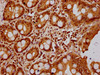 IHC image of CSB-PA010418OA23nbhbHU diluted at 1:20 and staining in paraffin-embedded human small intestine tissue performed on a Leica BondTM system. After dewaxing and hydration, antigen retrieval was mediated by high pressure in a citrate buffer (pH 6.0) . Section was blocked with 10% normal goat serum 30min at RT. Then primary antibody (1% BSA) was incubated at 4°C overnight. The primary is detected by a biotinylated secondary antibody and visualized using an HRP conjugated SP system.