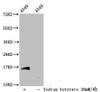 Western Blot<br />
 Detected samples: A549 whole cell lysate; Untreated (-) or treated (+) with 30mM sodium butyrate for 4h<br />
 All lanes: HIST1H3A antibody at 1:100<br />
 Secondary<br />
 Goat polyclonal to rabbit IgG at 1/50000 dilution<br />
 Predicted band size: 16 kDa<br />
 Observed band size: 16 kDa<br />