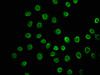 Immunofluorescence staining of A549 cells with CSB-PA010418OA23nbutHU at 1:10, counter-stained with DAPI. The cells were fixed in 4% formaldehyde, permeabilized using 0.2% Triton X-100 and blocked in 10% normal Goat Serum. The cells were then incubated with the antibody overnight at 4°C. The secondary antibody was Alexa Fluor 488-congugated AffiniPure Goat Anti-Rabbit IgG (H+L) . Immunofluorescence staining of A549 cells with CSB-PA010418OA23nbutHU at 1:10, counter-stained with DAPI. The cells were fixed in 4% formaldehyde, permeabilized using 0.2% Triton X-100 and blocked in 10% normal Goat Serum. The cells were then incubated with the antibody overnight at 4°C. The secondary antibody was Alexa Fluor 488-congugated AffiniPure Goat Anti-Rabbit IgG (H+L) .