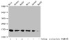 Western Blot<br />
 Detected samples: Hela whole cell lysate, Jurkat whole cell lysate, HepG2 whole cell lysate; Untreated (-) or treated (+) with 30mM sodium crotonylate for 4h<br />
 All lanes: HIST1H3A antibody at 1:100<br />
 Secondary<br />
 Goat polyclonal to rabbit IgG at 1/50000 dilution<br />
 Predicted band size: 16 kDa<br />
 Observed band size: 16 kDa<br />