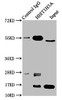 Immunoprecipitating HIST1H3A in Hela whole cell lysate (treated with 30mM sodium crotonylate for 4h) <br />
 Lane 1: Rabbit control IgG instead of CSB-PA010418OA09crHU in Hela whole cell lysate (treated with 30mM sodium crotonylate for 4h) .
 For western blotting, a HRP-conjugated Protein G antibody was used as the secondary antibody (1/2000) <br />
 Lane 2: CSB-PA010418OA09crHU (5µg) + Hela whole cell lysate (treated with 30mM sodium crotonylate for 4h) (500µg) <br />
 Lane 3: Hela whole cell lysate (treated with 30mM sodium crotonylate for 4h) (20µg) <br />