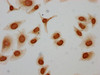 Immunocytochemistry analysis of CSB-PA010418OA122acHU diluted at 1:10 and staining in Hela cells (treated with 30mM sodium butyrate for 4h) performed on a Leica BondTM system. The cells were fixed in 4% formaldehyde, permeabilized using 0.2% Triton X-100 and blocked with 10% normal goat serum 30min at RT. Then primary antibody (1% BSA) was incubated at 4°C overnight. The primary is detected by a biotinylated secondary antibody and visualized using an HRP conjugated SP system.