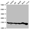 Western Blot<br />
 Positive WB detected in: Hela whole cell lysate, Jurkat whole cell lysate, 293 whole cell lysate, HepG2 whole cell lysate, Rat brain tissue, Rat liver tissue<br />
 All lanes: HIST1H3A antibody at 0.21µg/ml<br />
 Secondary<br />
 Goat polyclonal to rabbit IgG at 1/50000 dilution<br />
 Predicted band size: 16 kDa<br />
 Observed band size: 16 kDa<br />