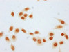 Immunocytochemistry analysis of CSB-PA010379OA106bhbHU diluted at 1:15 and staining in Hela cells (treated with 50mM sodium 3-hydroxybutyrate for 4h) performed on a Leica BondTM system. The cells were fixed in 4% formaldehyde, permeabilized using 0.2% Triton X-100 and blocked with 10% normal goat serum 30min at RT. Then primary antibody (1% BSA) was incubated at 4°C overnight. The primary is detected by a biotinylated secondary antibody and visualized using an HRP conjugated SP system.