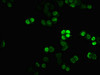Immunofluorescence staining of PC-3 cells with CSB-PA010378OA45nme1HU at 1:12.5, counter-stained with DAPI. The cells were fixed in 4% formaldehyde, permeabilized using 0.2% Triton X-100 and blocked in 10% normal Goat Serum. The cells were then incubated with the antibody overnight at 4°C. The secondary antibody was Alexa Fluor 488-congugated AffiniPure Goat Anti-Rabbit IgG (H+L) .
