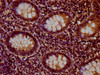 IHC image of CSB-PA010379OA90nbhbHU diluted at 1:20 and staining in paraffin-embedded human appendix tissue performed on a Leica BondTM system. After dewaxing and hydration, antigen retrieval was mediated by high pressure in a citrate buffer (pH 6.0) . Section was blocked with 10% normal goat serum 30min at RT. Then primary antibody (1% BSA) was incubated at 4°C overnight. The primary is detected by a biotinylated secondary antibody and visualized using an HRP conjugated SP system.