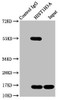 Immunoprecipitating HIST1H3A in Hela whole cell lysate<br />
 Lane 1: Rabbit control IgG instead of CSB-PA010418OA128nme1HU in Hela whole cell lysate.
 For western blotting, a HRP-conjugated Protein G antibody was used as the secondary antibody (1/2000) <br />
 Lane 2: CSB-PA010418OA128nme1HU (5µg) + Hela whole cell lysate (500µg) <br />
 Lane 3: Hela whole cell lysate (20µg) <br />
