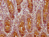IHC image of CSB-PA005474LA01HU diluted at 1:150 and staining in paraffin-embedded human small intestine tissue performed on a Leica BondTM system. After dewaxing and hydration, antigen retrieval was mediated by high pressure in a citrate buffer (pH 6.0) . Section was blocked with 10% normal goat serum 30min at RT. Then primary antibody (1% BSA) was incubated at 4°C overnight. The primary is detected by a biotinylated secondary antibody and visualized using an HRP conjugated SP system.