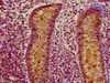 IHC image of CSB-PA005474LA01HU diluted at 1:150 and staining in paraffin-embedded human appendix tissue performed on a Leica BondTM system. After dewaxing and hydration, antigen retrieval was mediated by high pressure in a citrate buffer (pH 6.0) . Section was blocked with 10% normal goat serum 30min at RT. Then primary antibody (1% BSA) was incubated at 4°C overnight. The primary is detected by a biotinylated secondary antibody and visualized using an HRP conjugated SP system.