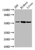 Western Blot<br />
 Positive WB detected in: 293 whole cell lysate, Mouse kidney tissue, Mouse liver tissue<br />
 All lanes: DBT antibody at 4.3µg/ml<br />
 Secondary<br />
 Goat polyclonal to rabbit IgG at 1/50000 dilution<br />
 Predicted band size: 54 kDa<br />
 Observed band size: 54 kDa<br />
