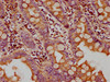 IHC image of CSB-PA009726LA01HU diluted at 1:400 and staining in paraffin-embedded human small intestine tissue performed on a Leica BondTM system. After dewaxing and hydration, antigen retrieval was mediated by high pressure in a citrate buffer (pH 6.0) . Section was blocked with 10% normal goat serum 30min at RT. Then primary antibody (1% BSA) was incubated at 4°C overnight. The primary is detected by a biotinylated secondary antibody and visualized using an HRP conjugated SP system.