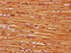 IHC image of CSB-PA020835LA01HU diluted at 1:300 and staining in paraffin-embedded human heart tissue performed on a Leica BondTM system. After dewaxing and hydration, antigen retrieval was mediated by high pressure in a citrate buffer (pH 6.0) . Section was blocked with 10% normal goat serum 30min at RT. Then primary antibody (1% BSA) was incubated at 4°C overnight. The primary is detected by a biotinylated secondary antibody and visualized using an HRP conjugated SP system.