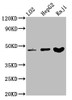 Western Blot<br />
 Positive WB detected in: LO2 whole cell lysate, HepG2 whole cell lysate, Raji whole cell lysate<br />
 All lanes: SERPINB2 antibody at 3.4µg/ml<br />
 Secondary<br />
 Goat polyclonal to rabbit IgG at 1/50000 dilution<br />
 Predicted band size: 47 kDa<br />
 Observed band size: 47 kDa<br /> Western Blot<br />
 Positive WB detected in: LO2 whole cell lysate, HepG2 whole cell lysate, Raji whole cell lysate<br />
 All lanes: SERPINB2 antibody at 3.4µg/ml<br />
 Secondary<br />
 Goat polyclonal to rabbit IgG at 1/50000 dilution<br />
 Predicted band size: 47 kDa<br />
 Observed band size: 47 kDa<br />