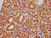 IHC image of CSB-PA021224LA01HU diluted at 1:400 and staining in paraffin-embedded human pancreatic tissue performed on a Leica BondTM system. After dewaxing and hydration, antigen retrieval was mediated by high pressure in a citrate buffer (pH 6.0) . Section was blocked with 10% normal goat serum 30min at RT. Then primary antibody (1% BSA) was incubated at 4°C overnight. The primary is detected by a biotinylated secondary antibody and visualized using an HRP conjugated SP system.
