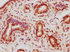 IHC image of CSB-PA361848LA01HU diluted at 1:400 and staining in paraffin-embedded human breast cancer performed on a Leica BondTM system. After dewaxing and hydration, antigen retrieval was mediated by high pressure in a citrate buffer (pH 6.0) . Section was blocked with 10% normal goat serum 30min at RT. Then primary antibody (1% BSA) was incubated at 4°C overnight. The primary is detected by a biotinylated secondary antibody and visualized using an HRP conjugated SP system.