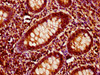 IHC image of CSB-PA621885LA01HU diluted at 1:400 and staining in paraffin-embedded human appendix tissue performed on a Leica BondTM system. After dewaxing and hydration, antigen retrieval was mediated by high pressure in a citrate buffer (pH 6.0) . Section was blocked with 10% normal goat serum 30min at RT. Then primary antibody (1% BSA) was incubated at 4°C overnight. The primary is detected by a biotinylated secondary antibody and visualized using an HRP conjugated SP system. IHC image of CSB-PA621885LA01HU diluted at 1:400 and staining in paraffin-embedded human appendix tissue performed on a Leica BondTM system. After dewaxing and hydration, antigen retrieval was mediated by high pressure in a citrate buffer (pH 6.0) . Section was blocked with 10% normal goat serum 30min at RT. Then primary antibody (1% BSA) was incubated at 4°C overnight. The primary is detected by a biotinylated secondary antibody and visualized using an HRP conjugated SP system.