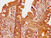 IHC image of CSB-PA719469LA01HU diluted at 1:400 and staining in paraffin-embedded human small intestine tissue performed on a Leica BondTM system. After dewaxing and hydration, antigen retrieval was mediated by high pressure in a citrate buffer (pH 6.0) . Section was blocked with 10% normal goat serum 30min at RT. Then primary antibody (1% BSA) was incubated at 4°C overnight. The primary is detected by a biotinylated secondary antibody and visualized using an HRP conjugated SP system.