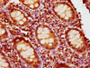 IHC image of CSB-PA719469LA01HU diluted at 1:400 and staining in paraffin-embedded human appendix tissue performed on a Leica BondTM system. After dewaxing and hydration, antigen retrieval was mediated by high pressure in a citrate buffer (pH 6.0) . Section was blocked with 10% normal goat serum 30min at RT. Then primary antibody (1% BSA) was incubated at 4°C overnight. The primary is detected by a biotinylated secondary antibody and visualized using an HRP conjugated SP system.