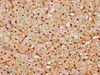 IHC image of CSB-PA774815LA01HU diluted at 1:300 and staining in paraffin-embedded human adrenal gland tissue performed on a Leica BondTM system. After dewaxing and hydration, antigen retrieval was mediated by high pressure in a citrate buffer (pH 6.0) . Section was blocked with 10% normal goat serum 30min at RT. Then primary antibody (1% BSA) was incubated at 4°C overnight. The primary is detected by a biotinylated secondary antibody and visualized using an HRP conjugated SP system.