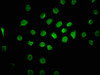 Immunofluorescence staining of A549 cells with CSB-PA774815LA01HU at 1:100, counter-stained with DAPI. The cells were fixed in 4% formaldehyde, permeabilized using 0.2% Triton X-100 and blocked in 10% normal Goat Serum. The cells were then incubated with the antibody overnight at 4°C. The secondary antibody was Alexa Fluor 488-congugated AffiniPure Goat Anti-Rabbit IgG (H+L) .