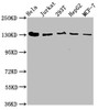 Western Blot<br />
 Positive WB detected in: Hela whole cell lysate, Jurkat whole cell lysate, 293T whole cell lysate, HepG2 whole cell lysate, MCF-7 whole cell lysate<br />
 All lanes: CAND1 antibody at 4.9µg/ml<br />
 Secondary<br />
 Goat polyclonal to rabbit IgG at 1/50000 dilution<br />
 Predicted band size: 137, 118, 46 kDa<br />
 Observed band size: 137 kDa<br />