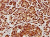 IHC image of CSB-PA839851LA01HU diluted at 1:800 and staining in paraffin-embedded human pancreatic cancer performed on a Leica BondTM system. After dewaxing and hydration, antigen retrieval was mediated by high pressure in a citrate buffer (pH 6.0) . Section was blocked with 10% normal goat serum 30min at RT. Then primary antibody (1% BSA) was incubated at 4°C overnight. The primary is detected by a biotinylated secondary antibody and visualized using an HRP conjugated SP system.