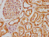 IHC image of CSB-PA847625LA01HU diluted at 1:200 and staining in paraffin-embedded human kidney tissue performed on a Leica BondTM system. After dewaxing and hydration, antigen retrieval was mediated by high pressure in a citrate buffer (pH 6.0) . Section was blocked with 10% normal goat serum 30min at RT. Then primary antibody (1% BSA) was incubated at 4°C overnight. The primary is detected by a biotinylated secondary antibody and visualized using an HRP conjugated SP system.
