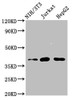 Western Blot<br />
 Positive WB detected in: NIH/3T3 whole cell lysate, Jurkat whole cell lysate, HepG2 whole cell lysate<br />
 All lanes: RNF2 antibody at 4µg/ml<br />
 Secondary<br />
 Goat polyclonal to rabbit IgG at 1/50000 dilution<br />
 Predicted band size: 38, 30 kDa<br />
 Observed band size: 38 kDa<br />