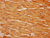 IHC image of CSB-PA861185LA01HU diluted at 1:350 and staining in paraffin-embedded human heart tissue performed on a Leica BondTM system. After dewaxing and hydration, antigen retrieval was mediated by high pressure in a citrate buffer (pH 6.0) . Section was blocked with 10% normal goat serum 30min at RT. Then primary antibody (1% BSA) was incubated at 4°C overnight. The primary is detected by a biotinylated secondary antibody and visualized using an HRP conjugated SP system.