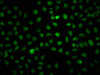 Immunofluorescence staining of Hela cells (treated with 30mM sodium butyrate for 4h) with CSB-PA010378OA168hibHU at 1:20, counter-stained with DAPI. The cells were fixed in 4% formaldehyde, permeabilized using 0.2% Triton X-100 and blocked in 10% normal Goat Serum. The cells were then incubated with the antibody overnight at 4°C. The secondary antibody was Alexa Fluor 488-congugated AffiniPure Goat Anti-Rabbit IgG (H+L) .