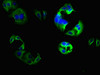 Immunofluorescence staining of HepG2 cells with CSB-PA005642LA01HU at 1:133, counter-stained with DAPI. The cells were fixed in 4% formaldehyde, permeabilized using 0.2% Triton X-100 and blocked in 10% normal Goat Serum. The cells were then incubated with the antibody overnight at 4°C. The secondary antibody was Alexa Fluor 488-congugated AffiniPure Goat Anti-Rabbit IgG (H+L) .