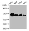 Western Blot<br />
 Positive WB detected in Recombinant protein<br />
 All lanes: cyp1a antibody at 4µg/ml<br />
 Secondary<br />
 Goat polyclonal to rabbit IgG at 1/50000 dilution<br />
 Predicted band size: 39 kDa<br />
 Observed band size: 47 kDa<br />