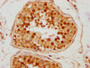 IHC image of CSB-PA688972LA01HU diluted at 1:300 and staining in paraffin-embedded human testis tissue performed on a Leica BondTM system. After dewaxing and hydration, antigen retrieval was mediated by high pressure in a citrate buffer (pH 6.0) . Section was blocked with 10% normal goat serum 30min at RT. Then primary antibody (1% BSA) was incubated at 4°C overnight. The primary is detected by a biotinylated secondary antibody and visualized using an HRP conjugated SP system.